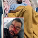 حد گاؤں میں مسلم نوجوان پر مبینہ گاؤ رکشکوں کا جان لیوا حملہ، شدید زخمی